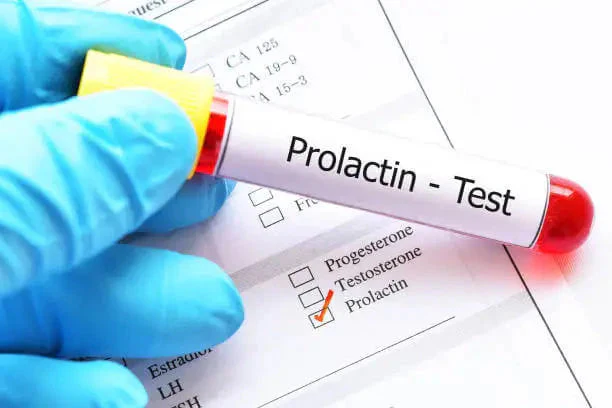 Prolactin in Men