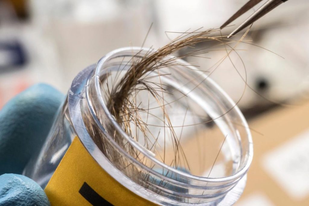 Hair Analysis