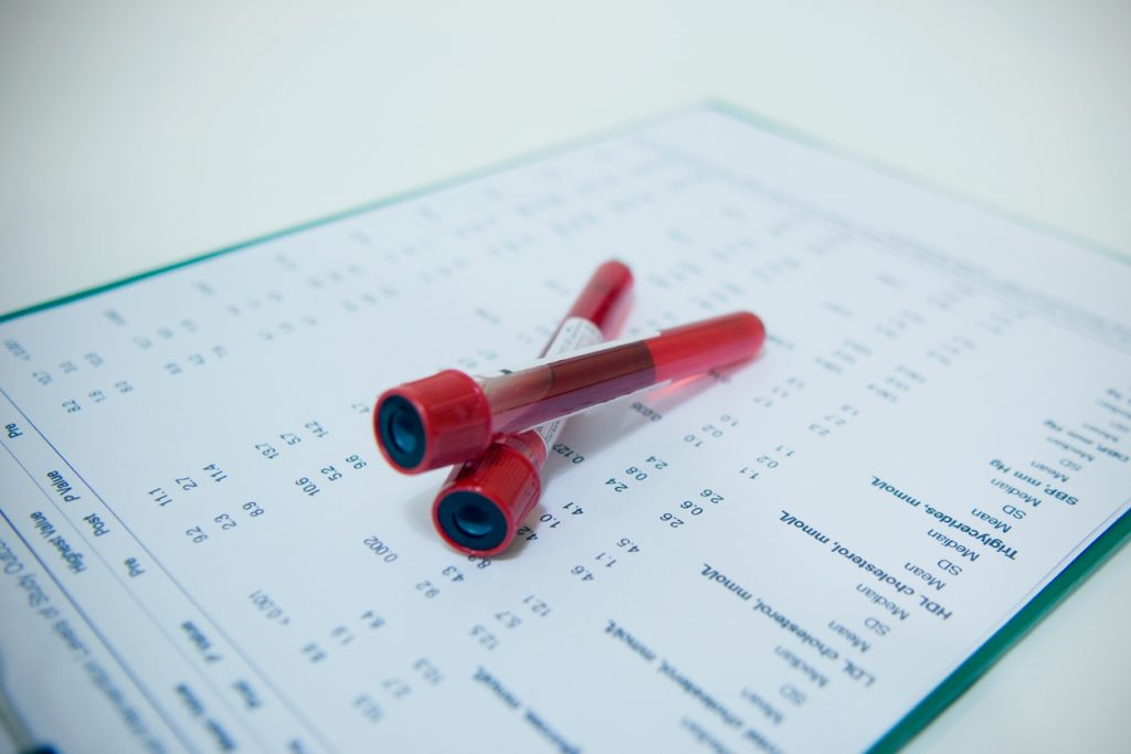 Testos-Men Hormone Screening